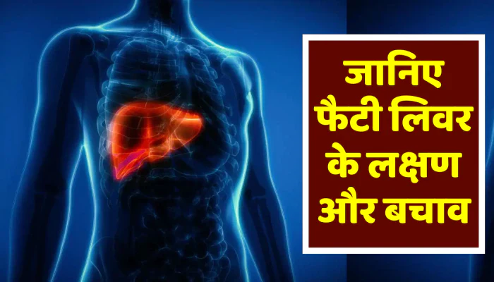 Fatty liver remedies